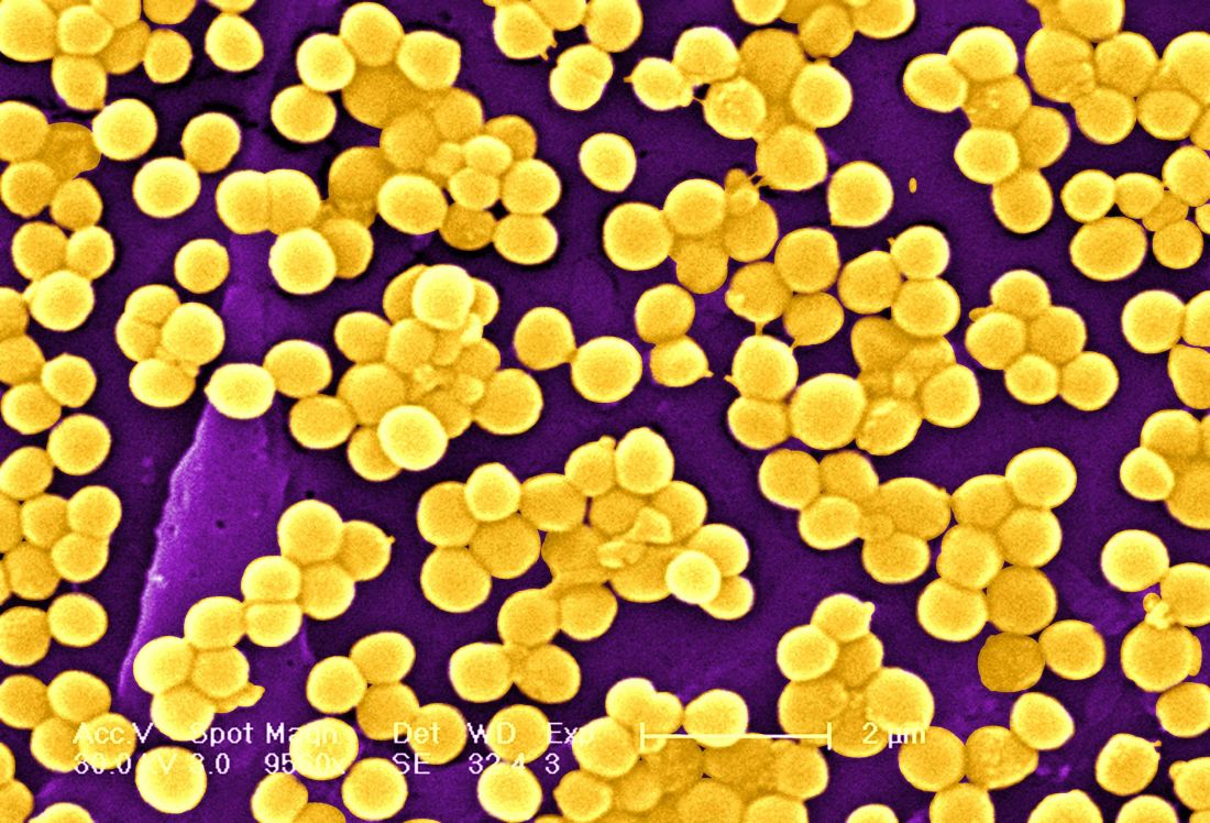 Purple and yellow image of Superbugs staphyloccus bacteria