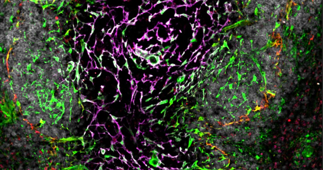 An advanced fluorescent microscopy image of the complex networks of stromal cells that construct the spleen and support immune responses.