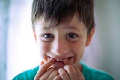The condition develops in childhood and impacts adult teeth. Image: Unsplash