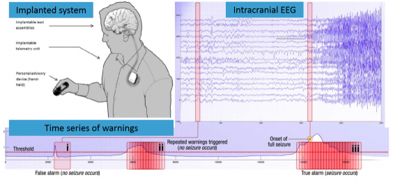 Predicting epileptic seizures