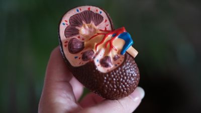 Image of a hand holding a model of a kidney.