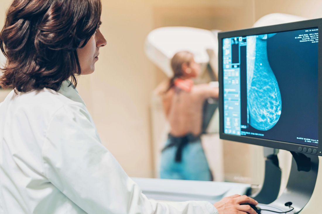 Doctor checking mammogram breast scan