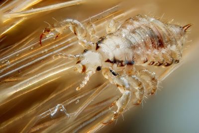 Head louse on hair
