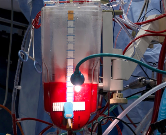 Image of blood donation.