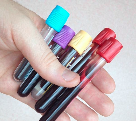 Image of test tubes filled with blood samples.