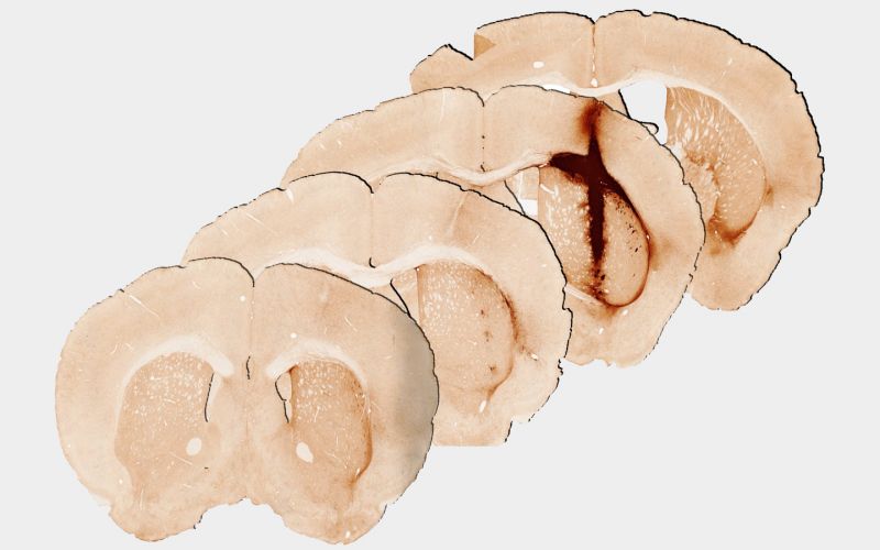Mouse brain tissue