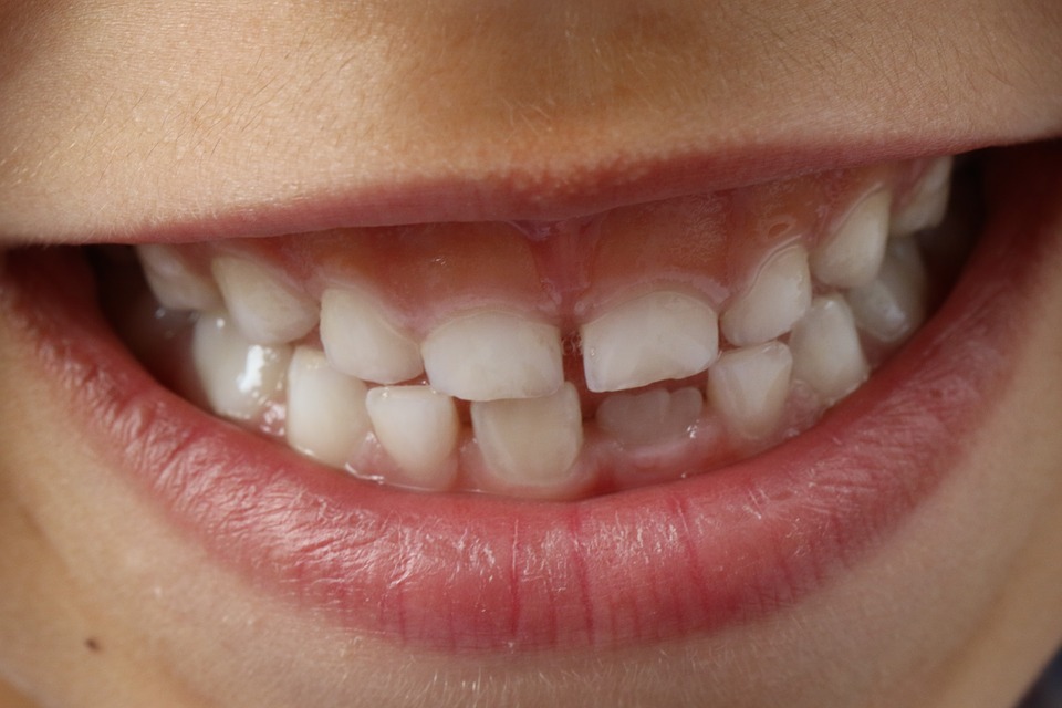 Close-up of a child's teeth.
