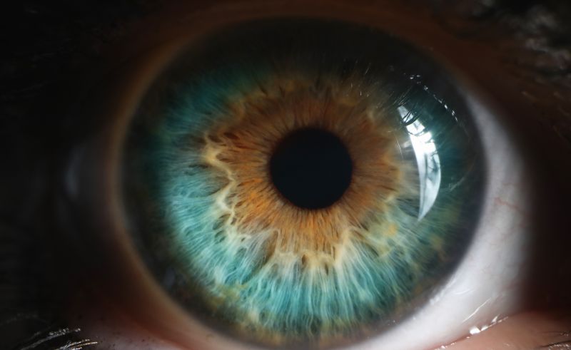 New research has given new insights into a severe form of age-related macular degeneration. Image: iStock