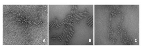 Transmission electron micrographys of amyloid fibrils.