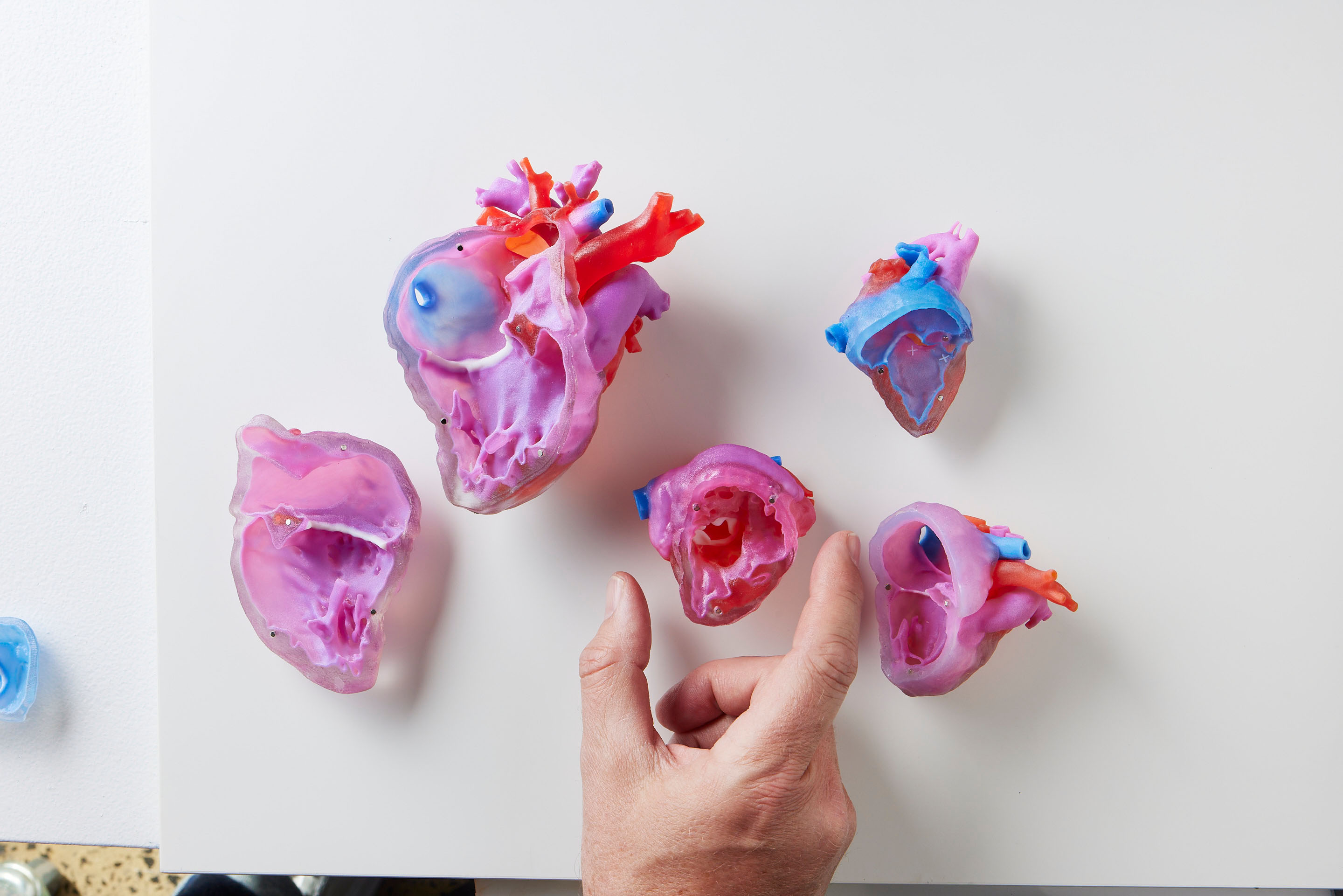 world's first anatomically accurate set of three-dimensional paediatric heart models. world's first anatomically accurate set of three-dimensional paediatric heart models.