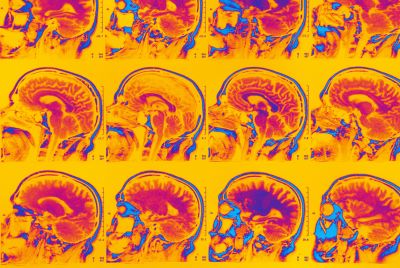 Brain MRI image