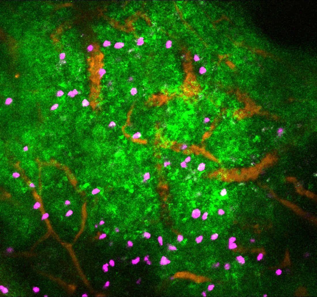 The image shows the impact of sympathetic nervous system activity in immune tissues (lymph node). Lymphocytes (purple) can be seen amongst blood vessels (orange) and the calcium signalling (green) that results from noradrenaline neurotransmitter release and causes immune cells to stop moving.