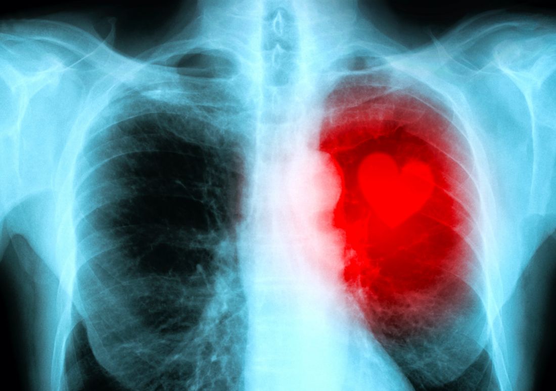 Chest x-ray with red love heart
