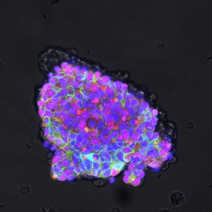 Colony of induced pluripotent stem cells made from the skin cells of the fat tailed dunnart. Image credit: TIGRR Lab and Colossal.