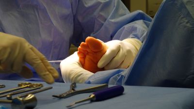 University of Melbourne, RMIT University and Bolton Clarke researchers have developed a thermal imaging tool to prevent diabetic foot ulcer hospitalisations and amputations. Picture: Pexels