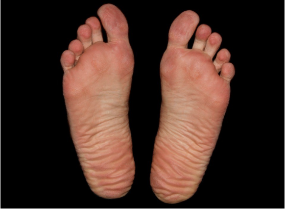 Image of the soles of a person's feet.
