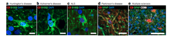 Images of astrocytes.