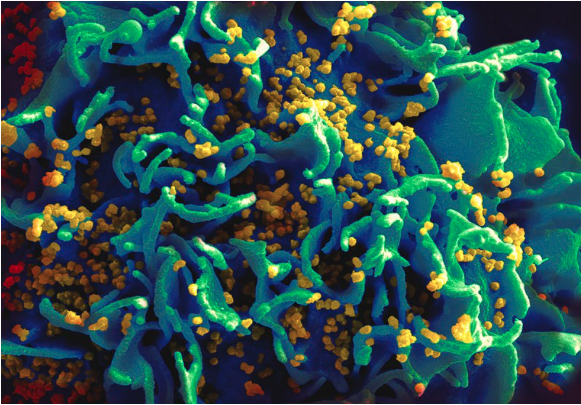 Microscopic image of a virus.