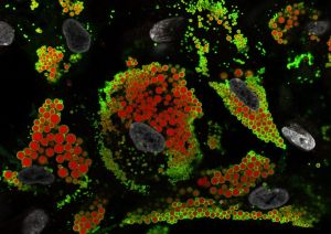 Image of a fat cell. 