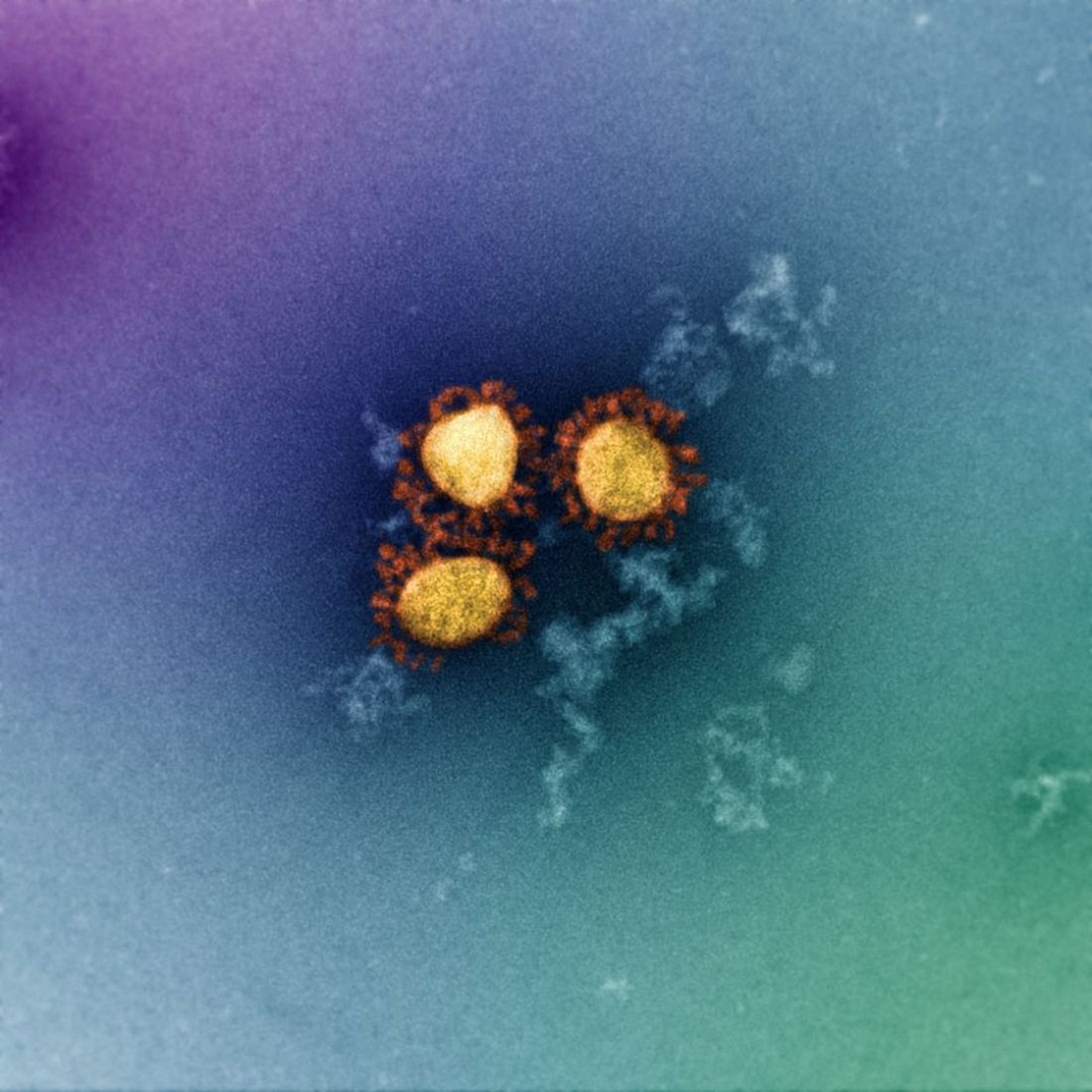 An electron microscopy image of the Omicron variant of SARS-CoV-2