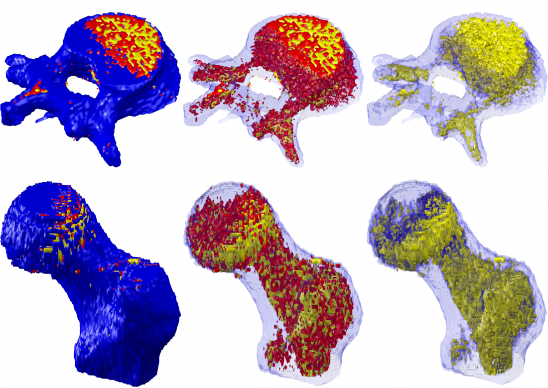 Example of bone images using Tissue Compass