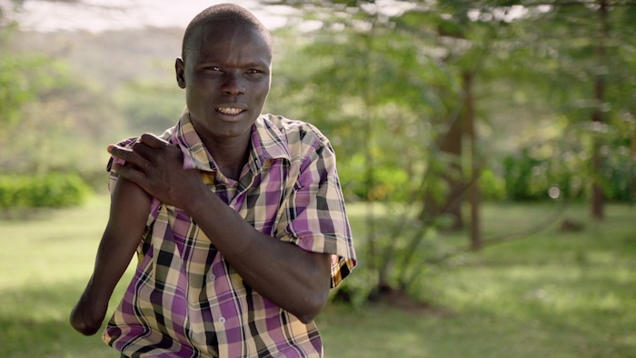 Snakebite victim Sundai, from Kenya’s Baringo County. Lillian Lincoln Foundation (www.minutestodie.com)