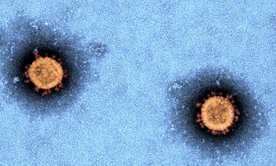 Virus image