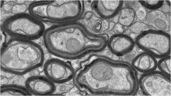 Microscopic image of Myelin Sheaths.