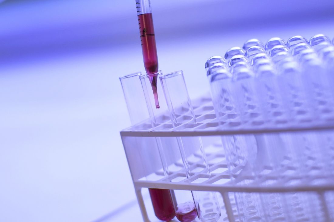 Test tubes in laboratory 